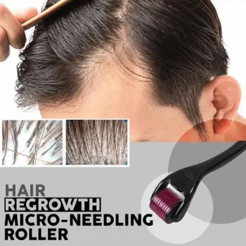 Titano Barzda & Plaukai Atauga Microneedling už kovą su Plaukų Slinkimas Gydymo, Retinimo Plaukų, Odos Volelis