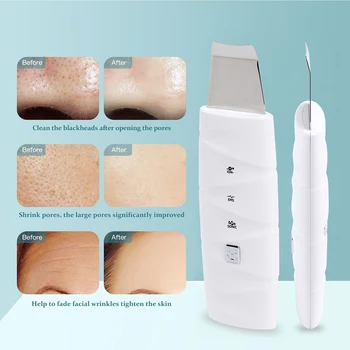 DODDOHOME veido massager odos priežiūrai Ultragarsinis veido valymo inkštirų ir spuogų veido valiklis Artefaktas