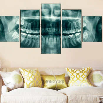 Sienos Menas Nuotraukas, Namų Dekoro Šiuolaikinių HD Spaudinių Drobės 5 Skydelis Dantų, Dantų rentgeno Stomatologas Tapybos Sveikatos Medicinos Plakatas