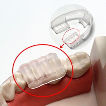 Dantų EVA Ortodontinis Petnešos Prietaisų Derinimas Treneris Bruxism Burnos apsaugą Dantų tiesinimo priemonė Dantų Priežiūros Priemonė